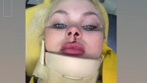 Lali Martínez sufrió múltiples heridas en su cuerpo y rostro