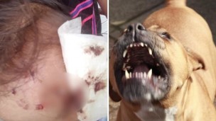 Beba atacada por un pitbull