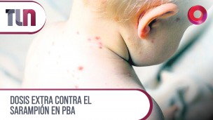 Dosis extra contra el sarampión en PBA