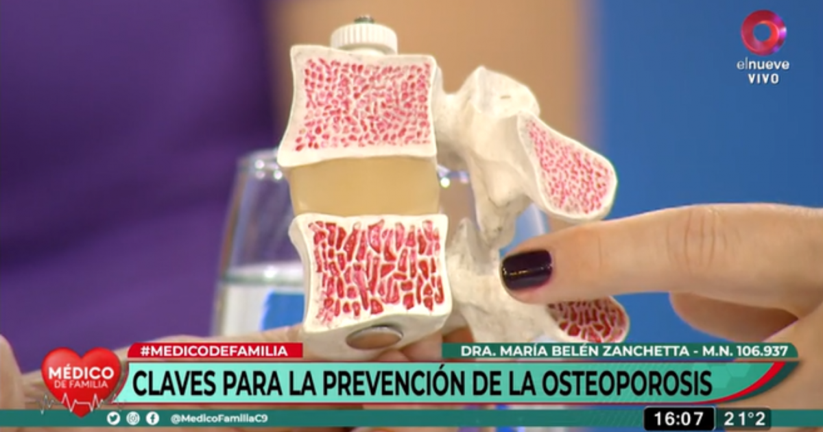 Osteoporosis Claves Para La Prevención Y El Tratamiento Canal 9 1943