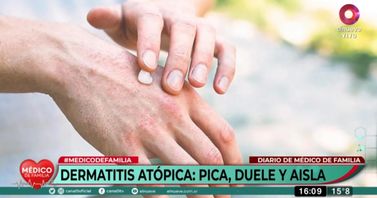 Dermatitis Atópica: ¿Por Qué Duele Y Pica Tanto La Piel? | Canal 9